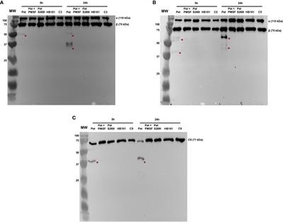 Plasmid-encoded toxin of Escherichia coli cleaves complement system proteins and inhibits complement-mediated lysis in vitro